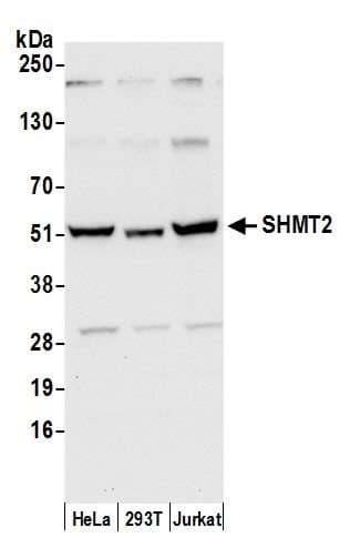 SHMT / SHMT2 Antibody (aa25-75)