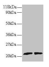 Polyclonal Rabbit anti-Human ARL2 Antibody (IHC, WB)