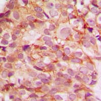 COL5A3 / Collagen V Alpha 3 Antibody (N-Terminus)