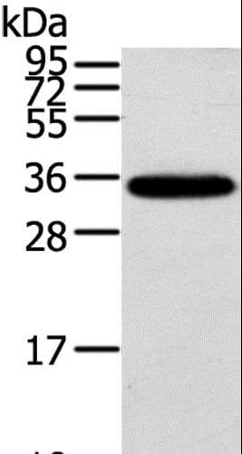 KCNMB3 Antibody (aa160-173)