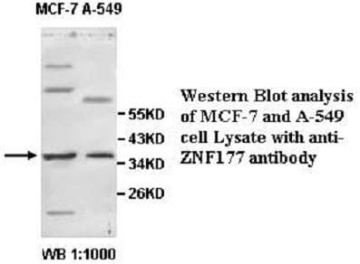 ZNF177 / PIGX Antibody (aa50-316)