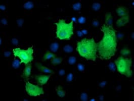 TMOD1 / Tropomodulin 1 Antibody (clone OTI6D3)
