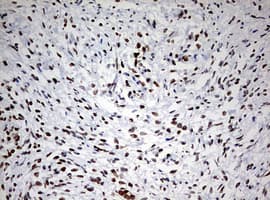 TOP2A / Topoisomerase II Alpha Antibody (aa1100-1531, clone OTI5E6, Carrier-free)