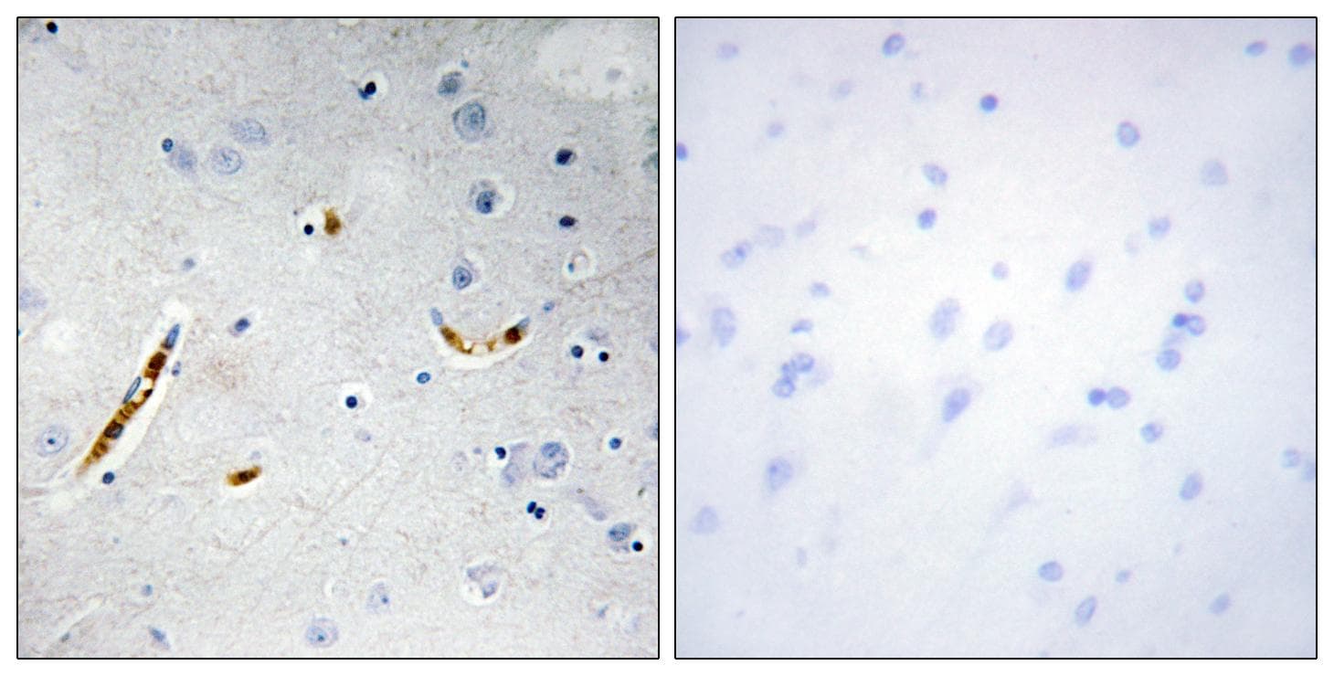 TCF3 / E2A Antibody