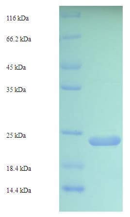 Human VWA5B2 Protein (Recombinant His-SUMO)