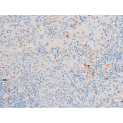 GATA4 Antibody (phospho-Ser105)