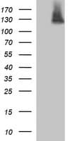 PDGFRB / PDGFR Beta Antibody (clone OTI1D2)