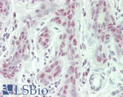IHC-plus™ RBM26 / SE70 Antibody (aa200-250)