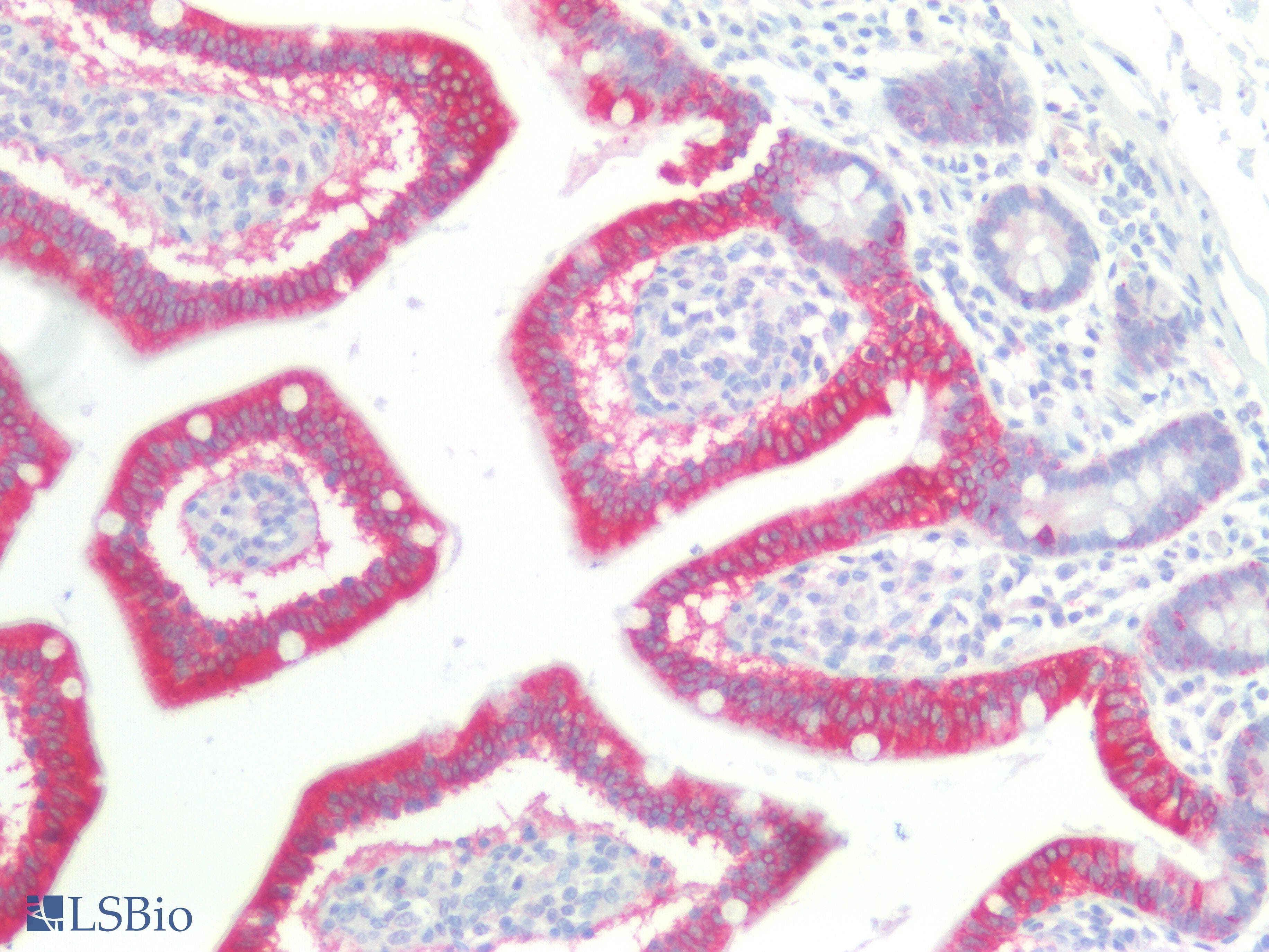 PathPlus™ Polyclonal Rabbit anti-Mouse CTNNBIP1 / ICAT Antibody (aa1-81, IHC, WB)
