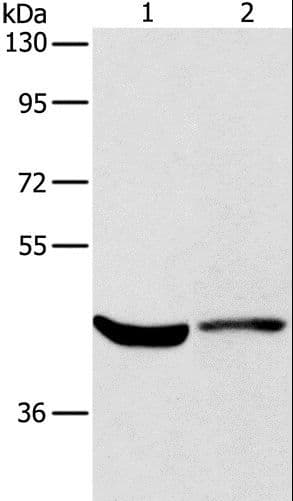 Polyclonal Rabbit anti-Human KCNA7 / Kv1.7 Antibody (IHC, WB)