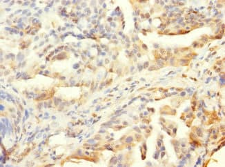 HCFC1R1 / HPIP Antibody
