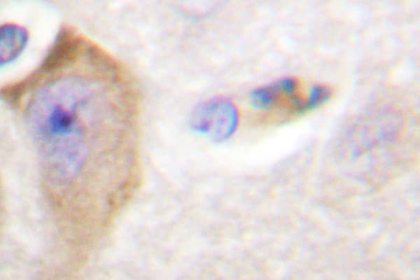 Polyclonal Rabbit anti-Human PTPN11 / SHP-2 / NS1 Antibody (Tyr542, IHC, WB)