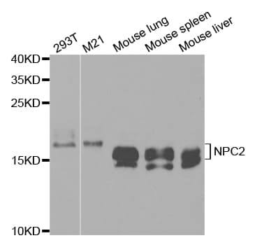 Polyclonal Rabbit anti-Human NPC2 Antibody (IHC, IF, WB)