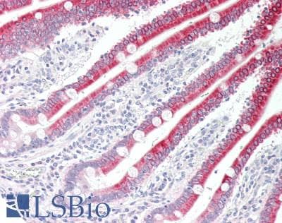 IHC-plus™ DGAT1 Antibody (aa1-62)