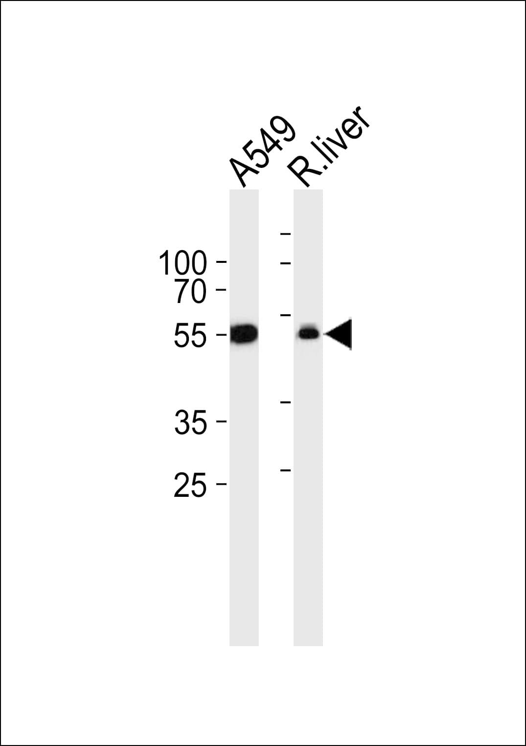 ALDH1A1 / ALDH1 Antibody (aa306-339)