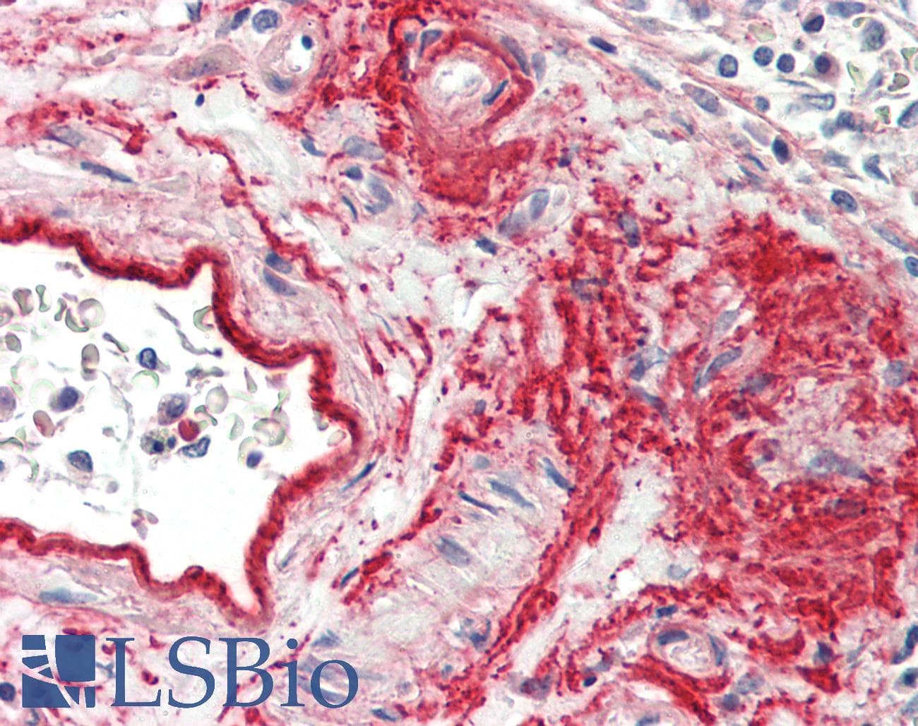 Polyclonal Rabbit anti-Human COL8A1 / Collagen VIII Alpha 1 Antibody (aa575-743, IHC, WB)