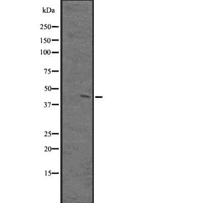 PKNOX1 / PREP1 Antibody