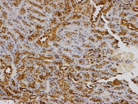 Polyclonal Rabbit anti-Human Osteonectin / SPARC Antibody (IHC, WB)