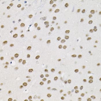 SMARCD1 / BAF60A Antibody
