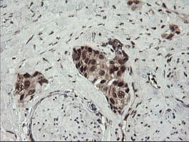 NUMB Antibody (clone OTI4F3, Carrier-free)