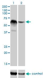 IHC-plus™ RBM5 / G15 Antibody (clone 2B6)