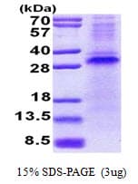 Human RCHY1 / PIRH2 Protein (Recombinant His)
