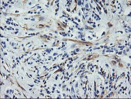 Monoclonal Mouse anti-Human CNN2 Antibody (clone OTI2B5, IHC, IF, WB)