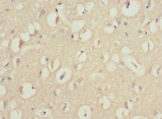 Polyclonal Rabbit anti-Human WNT7B Antibody (IHC, WB)