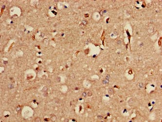 Polyclonal Rabbit anti-Human SORCS2 Antibody (aa712-786, IHC, IF)