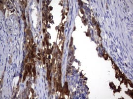 TS / Thymidylate Synthase Antibody (clone OTI1A3)