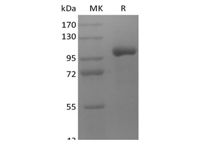 Human LRRC32 Protein (Recombinant Fc, C-terminus)