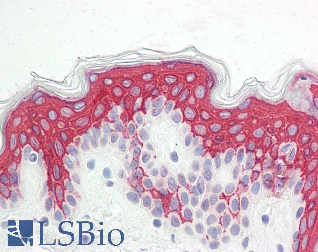 IHC-plus™ VPS13B Antibody
