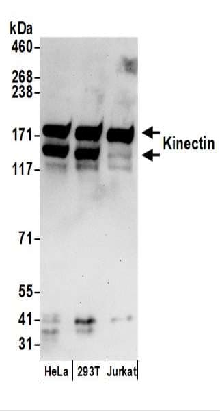 KTN1 / Kinectin Antibody (aa150-200)