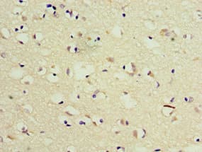 TSEN2 Antibody