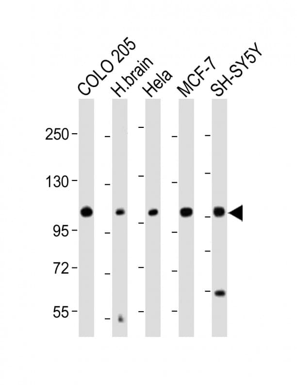 Kv10.1 / KCNH1 Antibody (C-Terminus)