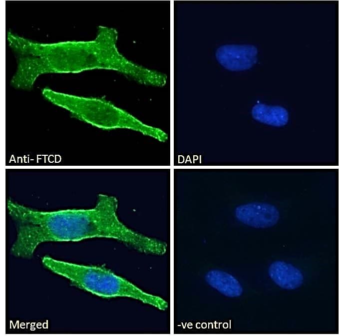 IHC-plus™ FTCD / 58K Golgi Protein Antibody (aa203-216)