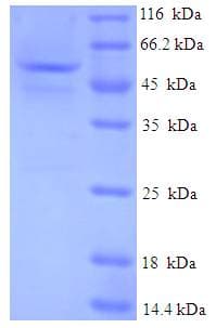 Human GMPR1 / GMPR Protein (Recombinant His-SUMO)