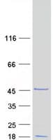 Human PXMP2 Protein (Recombinant Myc-DDK (Flag))