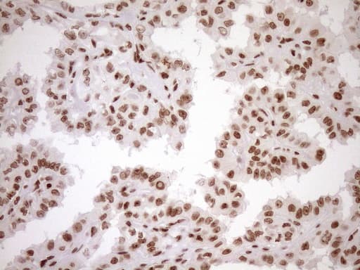 EXOSC1 / CSL4 Antibody (clone OTI1H9)