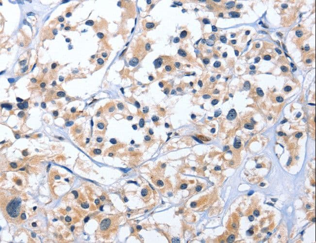 Endothelin 3 / EDN3 Antibody