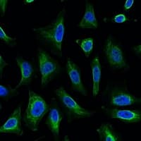 Monoclonal Mouse anti-Human AQP4 / Aquaporin 4 Antibody (IHC, IF, WB)