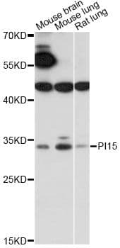 Polyclonal Rabbit anti-Human PI15 Antibody (WB)