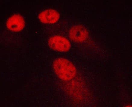 MKI67 / Ki67 Antibody