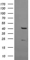 MSI1 / Musashi 1 Antibody (clone OTI3C2, Carrier-free)