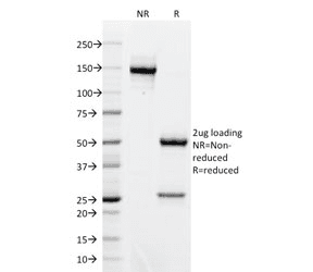 BCL6 Antibody (clone BCL6/1718, Azide-free, BSA-free)