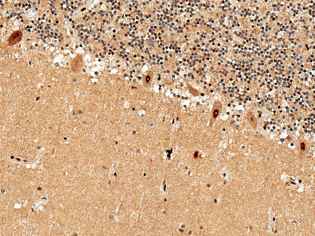 ADORA1 / Adenosine A1 Receptor Antibody