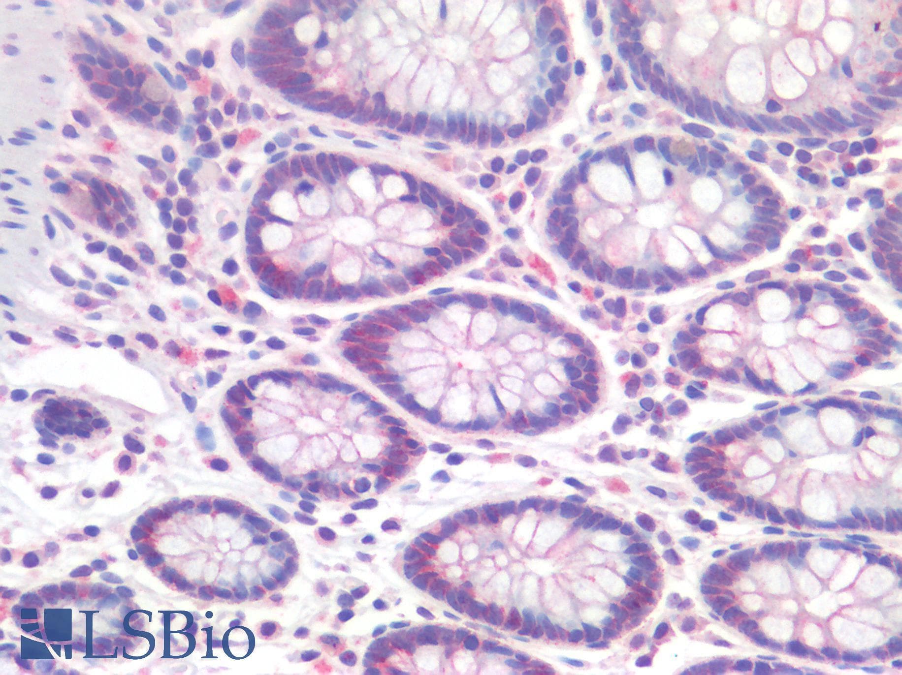 PathPlus™ CTNND1 / p120 Catenin Antibody