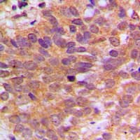 ABL1 / c-ABL Antibody (C-Terminus)