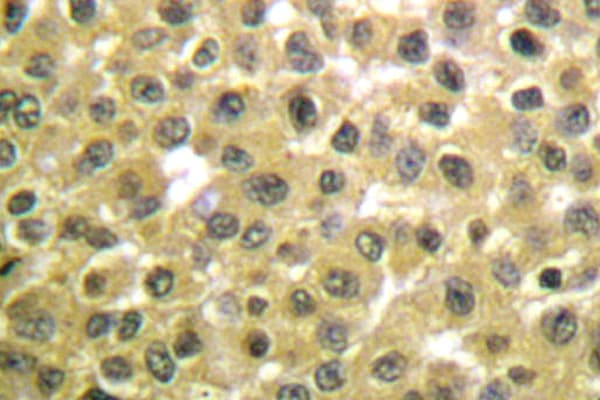 RARB / RAR Beta Antibody (Leu359)