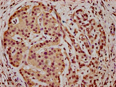 HIST1H3A Antibody